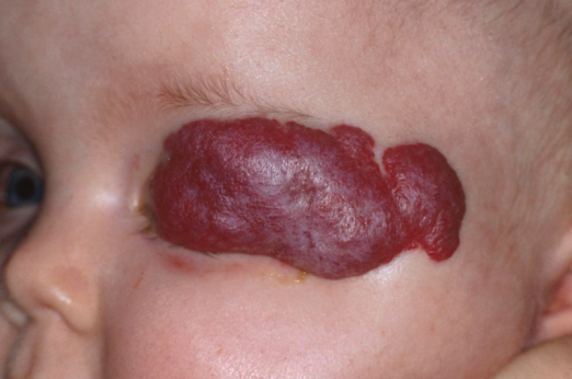 Klinický príklad – tvár