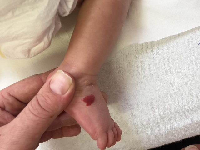 Mnohopočetný hemangióm